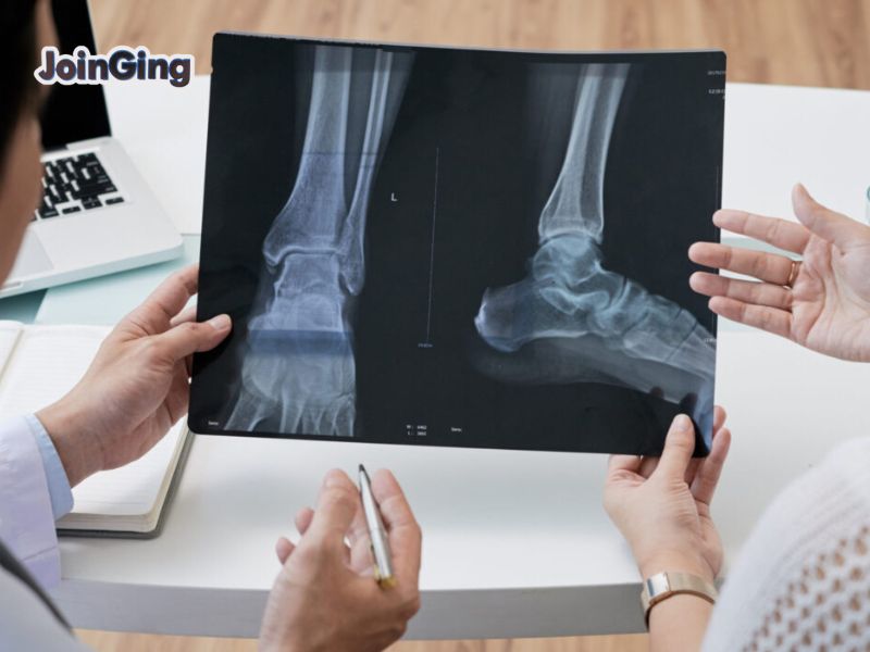 Chụp X-quang phân biệt đứt dây chằng và gãy xương cổ chân 